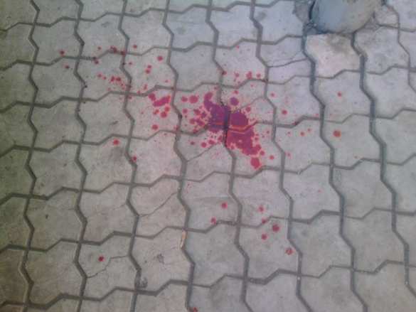 ВАЖНО: В Донецке скорая помощь попала под обстрел ВСУ, ранены три человека (+ВИДЕО, ФОТО) | Русская весна