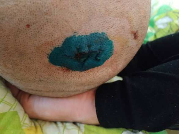 Неонацисты в Харькове жестоко расправляются с «ветеранами АТО» (ВИДЕО, ФОТО 18+) | Русская весна