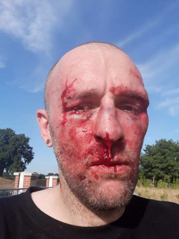 В Польше жестоко избили журналиста, критиковавшего надпись против «педофилов из ЛГБТ» (ФОТО, ВИДЕО 18+) | Русская весна