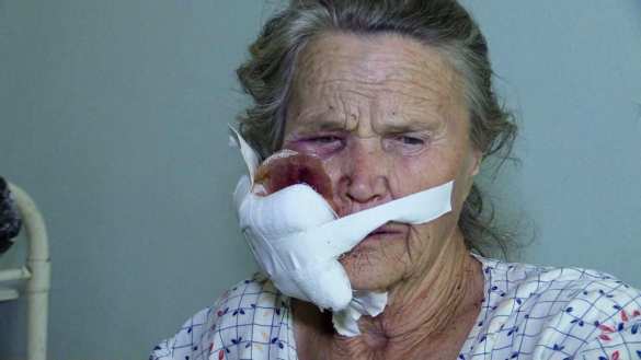 В Донбассе огнём ВСУ ранена 82-летняя женщина (ФОТО) | Русская весна