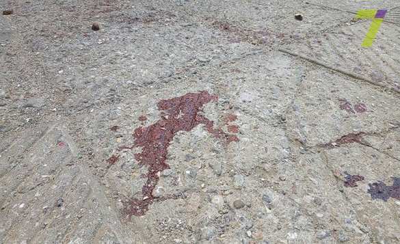 Типичная Украина: в Одессе нацгвардейца пырнули ножом (ФОТО) | Русская весна