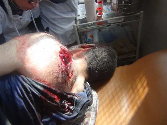 Террористы продолжают стирать с лица земли жилые кварталы и уничтожать мирное население в Алеппо (ФОТО 21+) | Русская весна