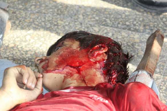 Шокирующие кадры геноцида в Алеппо: террористы убивают сирийских детей (ФОТО, ВИДЕО 21+) | Русская весна