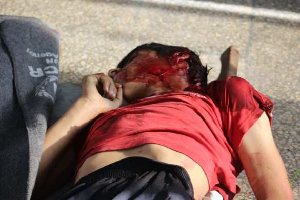 Шокирующие кадры геноцида в Алеппо: террористы убивают сирийских детей (ФОТО, ВИДЕО 21+) | Русская весна