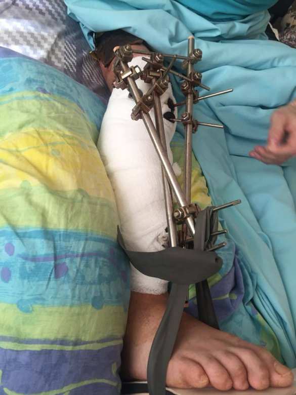 Колонна «скорых»: в Киев доставили раненых карателей (ФОТО 18+) | Русская весна