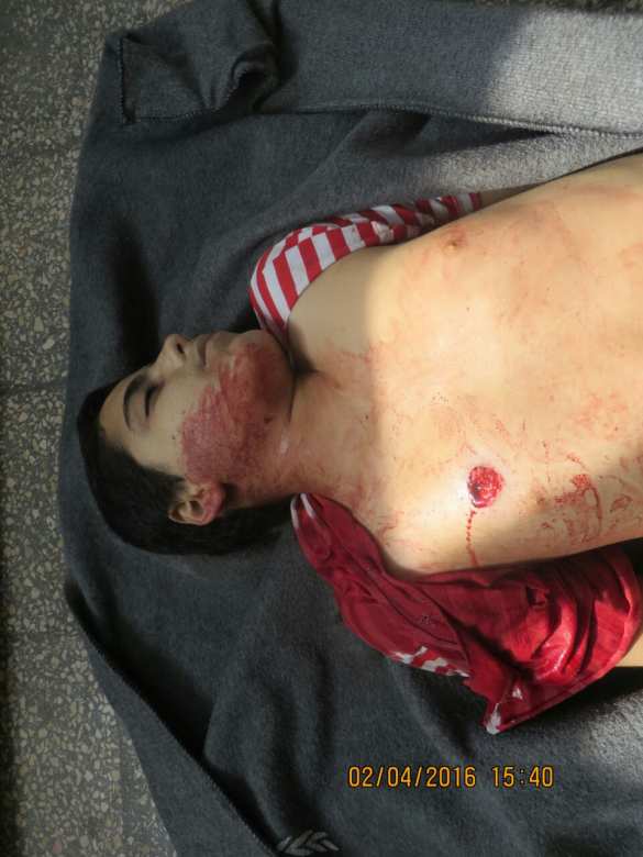 «Жизнь в аду»: жители Алеппо рассказывают о жестоком терроре мирного населения (ВИДЕО, ФОТО 18+) | Русская весна