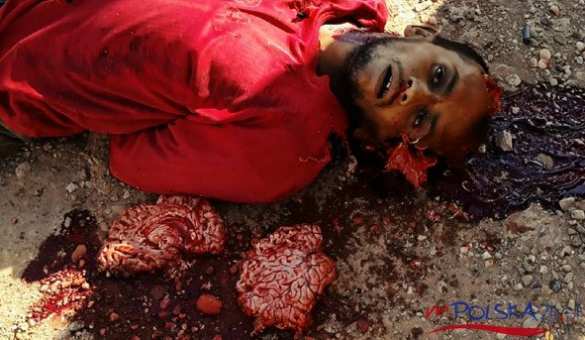 Шокирующие кадры: Против чего Россия воюет в Сирии (ФОТО СТРОГО 21+) | Русская весна