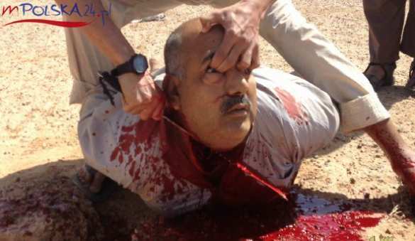 Шокирующие кадры: Против чего Россия воюет в Сирии (ФОТО СТРОГО 21+) | Русская весна