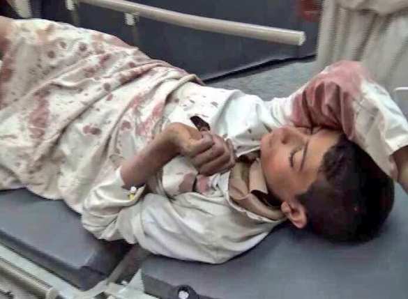 Авиация саудитов разбомбила школу в Йемене, погибли дети (ФОТО 18+) | Русская весна