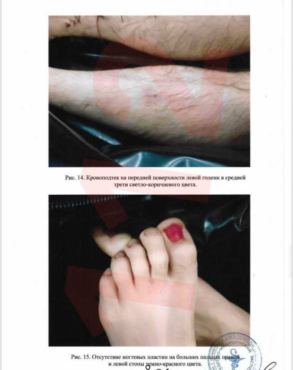 Судмедэксперт: «Тесака» перед смертью зверски пытали (ФОТО) | Русская весна