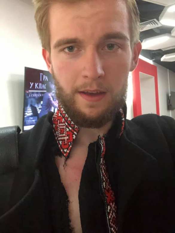 Это Украина: нардеп Барна напал на соратника Зеленского (ФОТО, ВИДЕО) | Русская весна