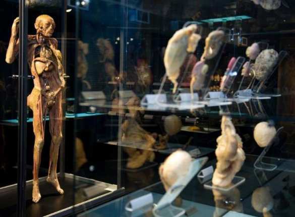 В Петербурге открывается скандальная выставка «Тело человека» (ФОТО, ВИДЕО 18+) | Русская весна