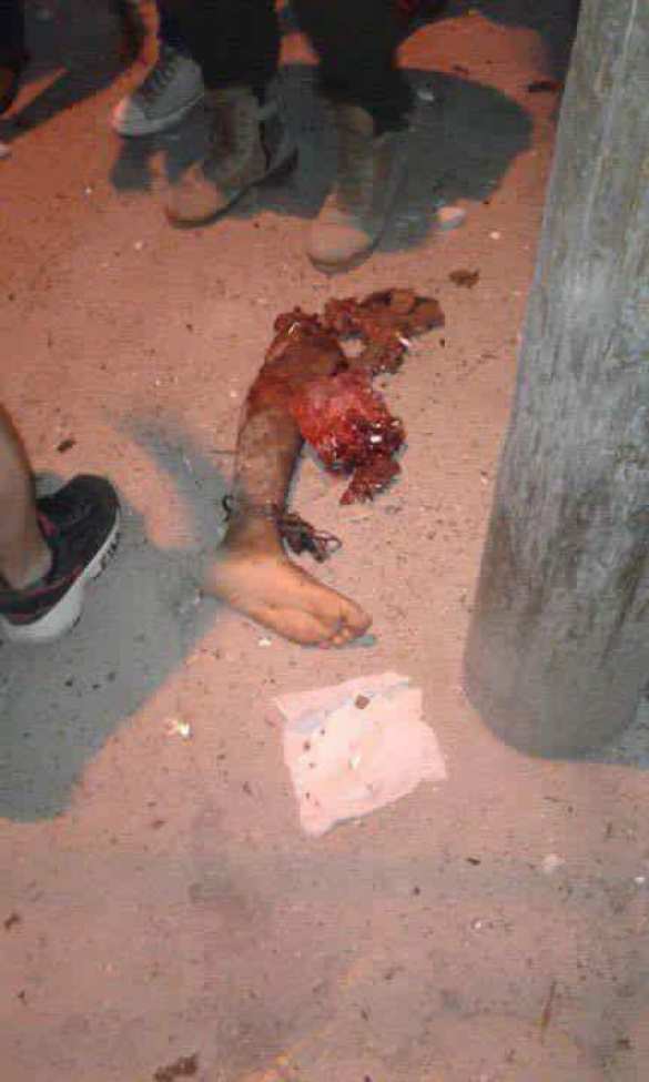 МОЛНИЯ: кровавый теракт, смертника ИГИЛ разорвало на части при подрыве христианского квартала в сирийском Камышлы (ФОТО 21+) | Русская весна