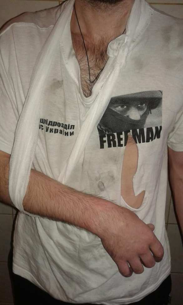 Вместо суда «боевых педофилов» из «Торнадо» жестоко избили (+ФОТО) | Русская весна