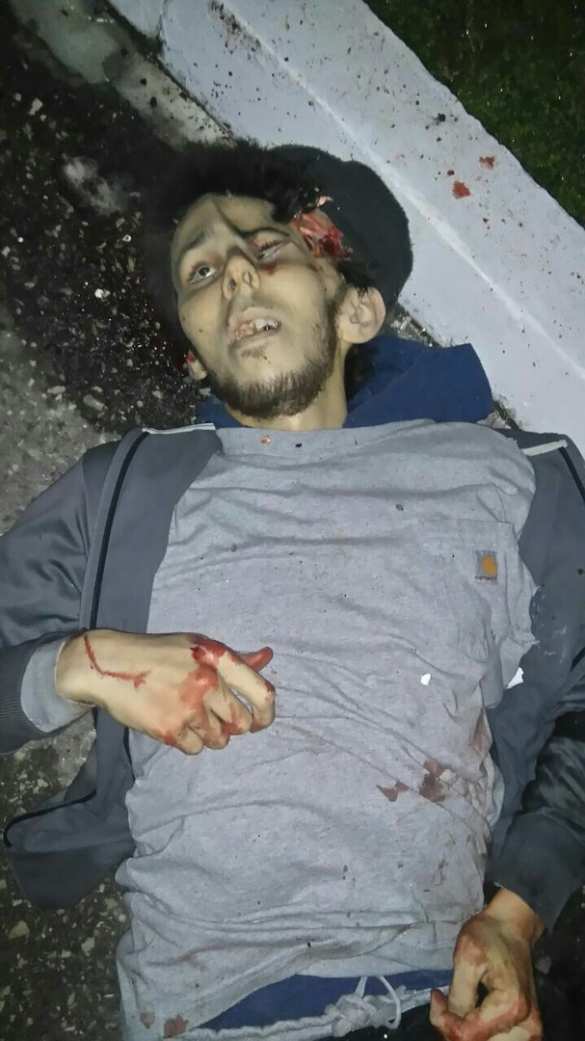 Опубликованы кадры с убитыми боевиками, напавшими на часть Росгвардии в Чечне (ФОТО, ВИДЕО 21+) | Русская весна