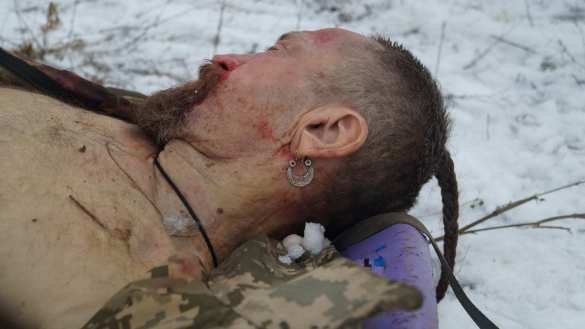 ВАЖНО: ВСУ понесли потери при попытке прорыва позиций ВС ДНР — экстренное заявление (ФОТО, ВИДЕО строго 21+) | Русская весна