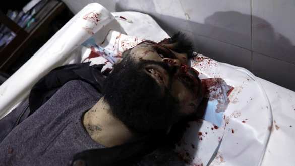 Жуткие кадры: Враг нанёс удар по самому крупному городу Сирии (ФОТО 18+) | Русская весна