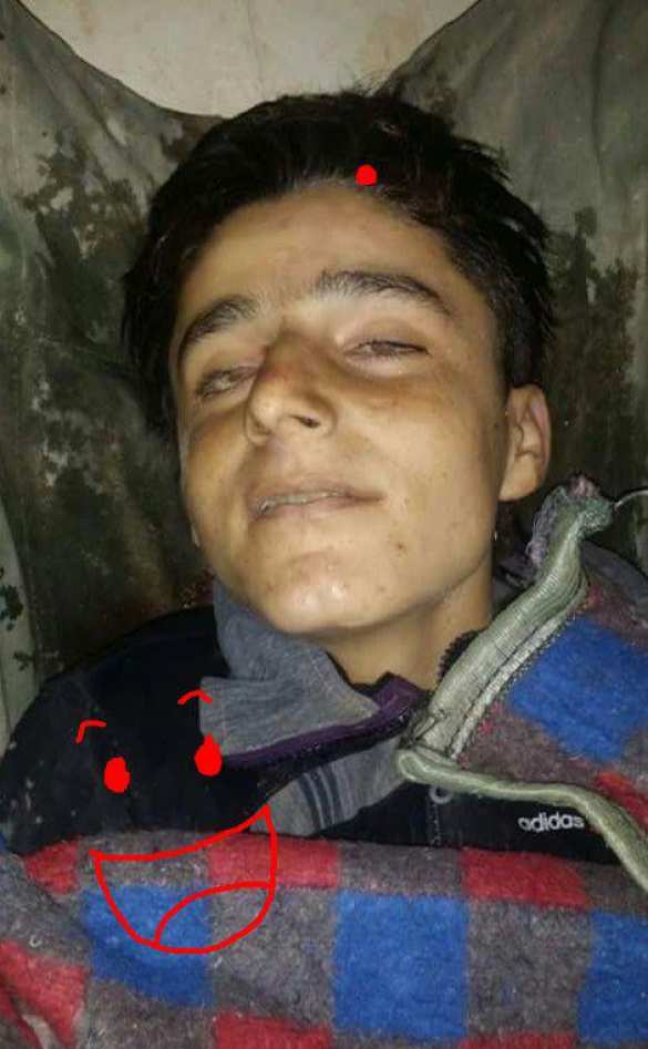 Ужасающие потери Алеппского котла: сотни боевиков убиты и ранены огнём «Тигров» и авиации (ВИДЕО, ФОТО 18+) | Русская весна