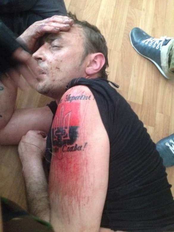 Перед сдачей в плен украинский фашист пытался кирпичом стереть татуировку «Правого сектора» (ФОТО) | Русская весна
