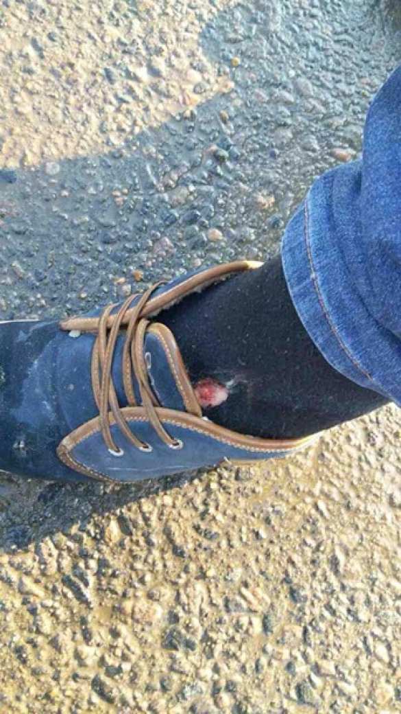 Это Украина: экс-зампрокурора и «атошник» устроили перестрелку (ФОТО) | Русская весна