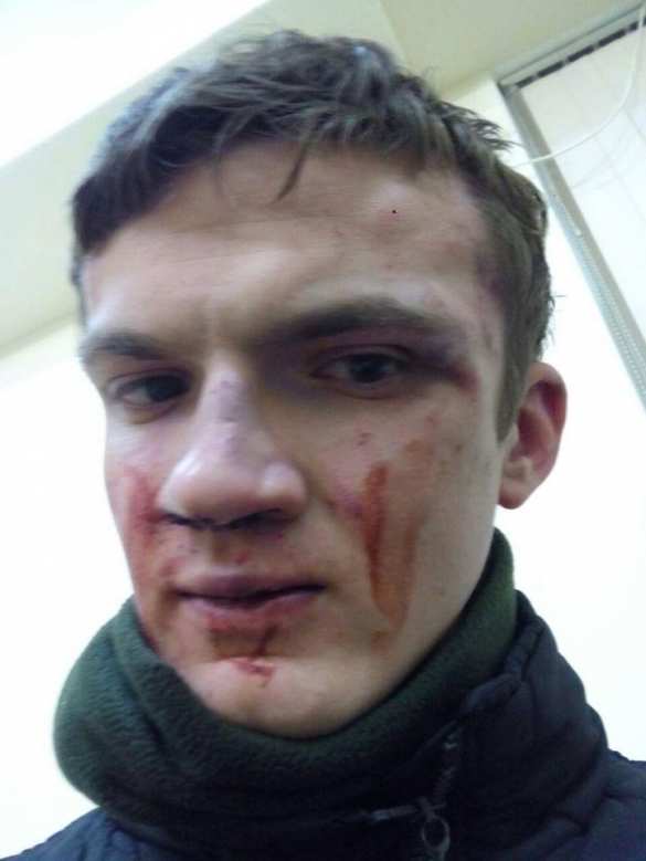 Дикий Киев: неонацистку Заверуху «побратимы» избили после освобождения (ФОТО) | Русская весна