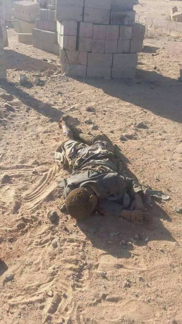 Шокирующие кадры: ВВС саудовской коалиции нанесли авиудары по госпиталю «Врачей без границ» в Йемене — 33 убитых, более 40 раненых (ФОТО, ВИДЕО 18+) | Русская весна