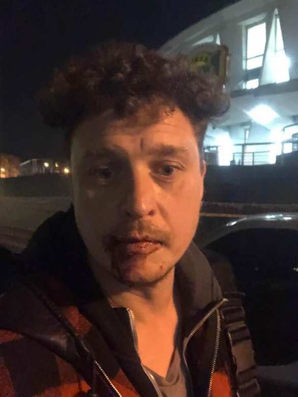 «Я люблю рашку!» — в Киеве избили режиссёра-русофоба (ФОТО) | Русская весна