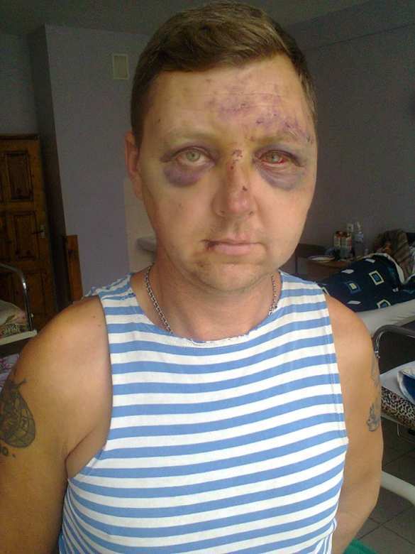 Покарали карателя: в Запорожье зверски избили «героя «АТО» (ФОТО) | Русская весна