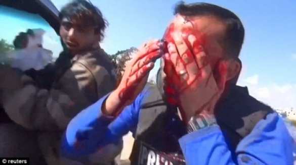 Шокирующие кадры: В журналиста, работающего на боевиков, в прямом эфире попал осколок авиабомбы (+ФОТО, ВИДЕО 18+) | Русская весна