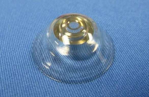 Телескопические контактные линзы увеличивают изображение почти в 3 раза | Русская весна