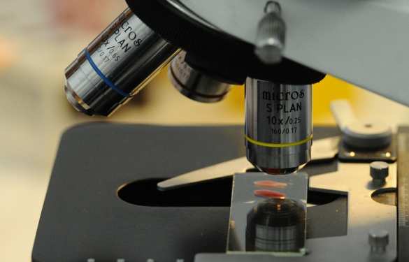 Уникальный метод диагностики по красным кровяным клеткам открыли в Новосибирске | Русская весна