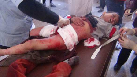 «Спасите, нас уничтожают!» — за жителями Алеппо охотятся снайпера, боевики убивают сирийцев с помощью «Адского огня» — репортаж (ВИДЕО, ФОТО 18+) | Русская весна