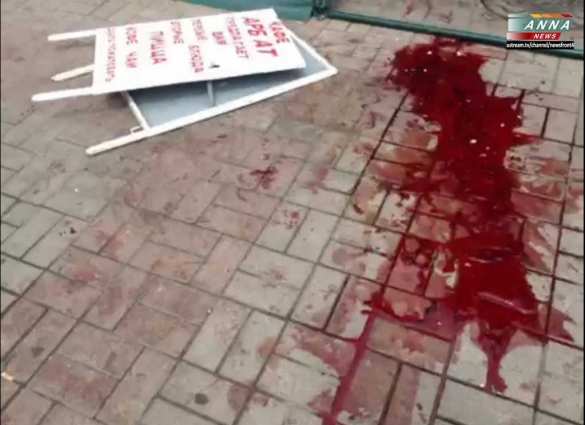 В Мариуполе сотрудник Russia Today был ранен в живот (видео)  | Русская весна