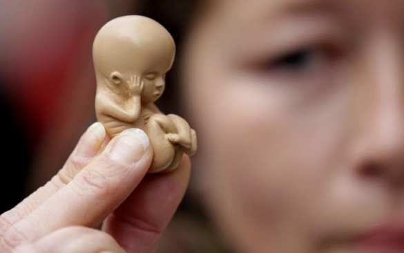 В 14 регионах России все коммерческие клиники отказались от проведения абортов | Русская весна