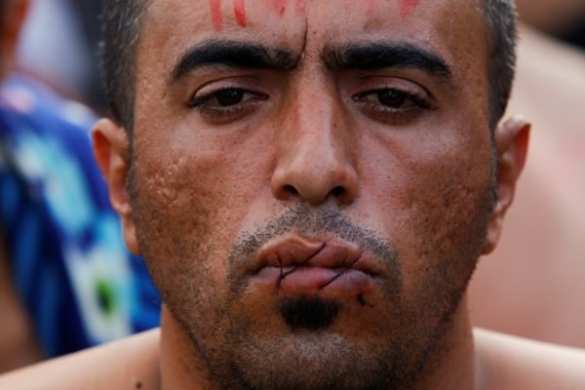 Мигранты зашили рты в знак протеста (ФОТО, ВИДЕО) | Русская весна