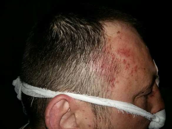 Шок для «патриотов»: в Киеве полиция избила «атошников», устроивших потасовку в кафе (ФОТО, ВИДЕО 18+) | Русская весна