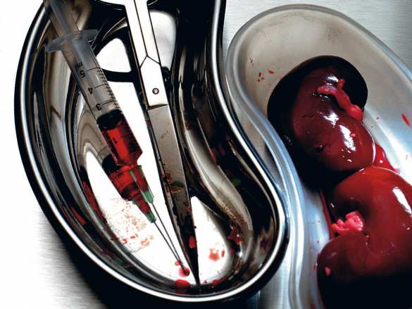 20 отчаявшихся украинцев продали свои органы в Казахстане: возбуждено уголовное дело | Русская весна