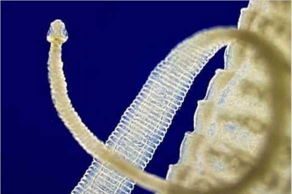 В честь Обамы назвали плоского червя-паразита | Русская весна