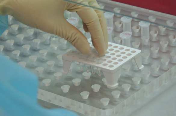 Украина не может идентифицировать своих погибших солдат | Русская весна