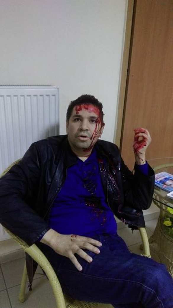 В Харькове избили кандидата в мэры (ФОТО) | Русская весна