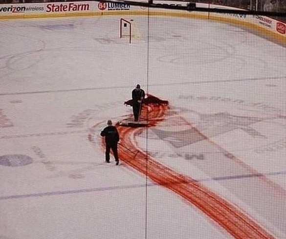 Зрелище не для слабонервных: хоккеисту распороли ногу коньком (ВИДЕО 18+) | Русская весна