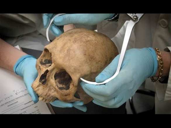 Украина проводит на Донбассе «АГО» — «антигенетическую операцию» (ВИДЕО)  | Русская весна