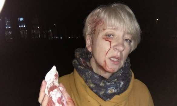 В Полтаве жестоко избили судью, выступавшую против местных властей (ФОТО, ВИДЕО) | Русская весна