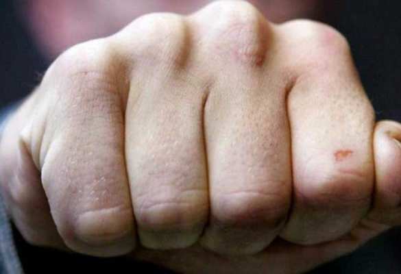 В Одессе судья сломал нос местному активисту | Русская весна