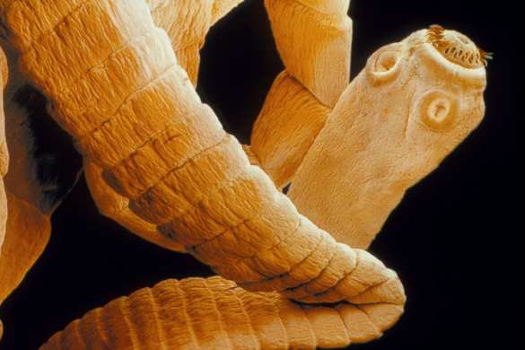 Американский любитель суши вытащил из себя полутораметрового червя (ФОТО) | Русская весна