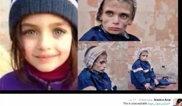 Чудовищная ложь западных и арабских СМИ о Сирии: трупы, изувеченные дети и голод в Мадайя (ФОТО) | Русская весна