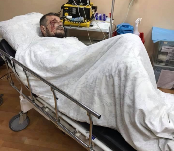 Помощница нардепа Мосийчука рассказала о его состоянии после покушения | Русская весна