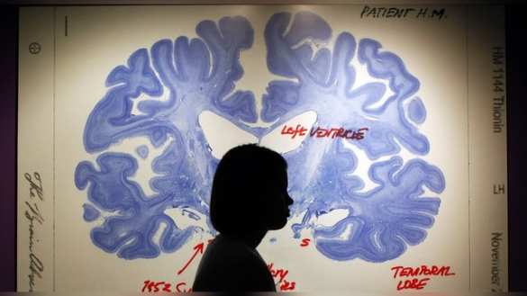 Российский миллионер ищет бессмертие в создании цифровой копии мозга, — BBC | Русская весна