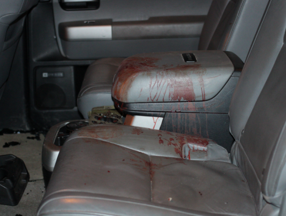 «Я всех прощаю», — А. Мозговой после перевязки вернулся к обязанностям и рассказал о покушении (ФОТО, ВИДЕО) | Русская весна