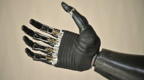 Роботизированный протез кисти разработан в Новосибирске | Русская весна